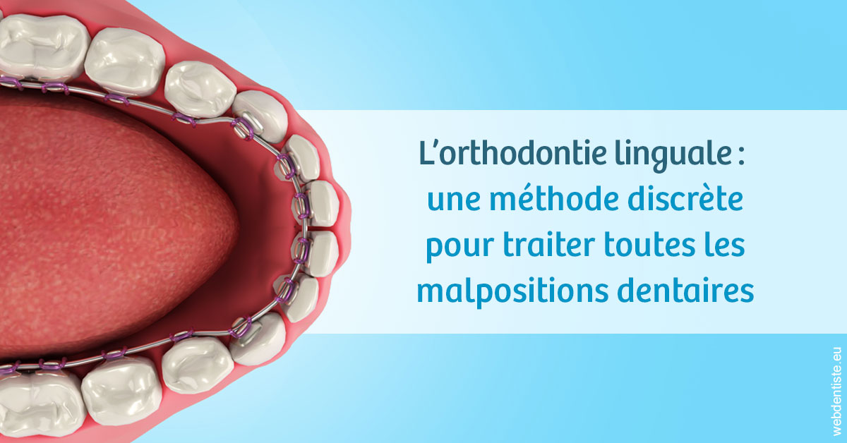https://selarl-chirdentiste-drherve.chirurgiens-dentistes.fr/L'orthodontie linguale 1