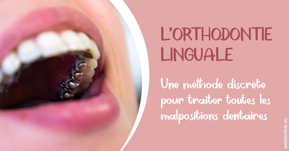 https://selarl-chirdentiste-drherve.chirurgiens-dentistes.fr/L'orthodontie linguale 2