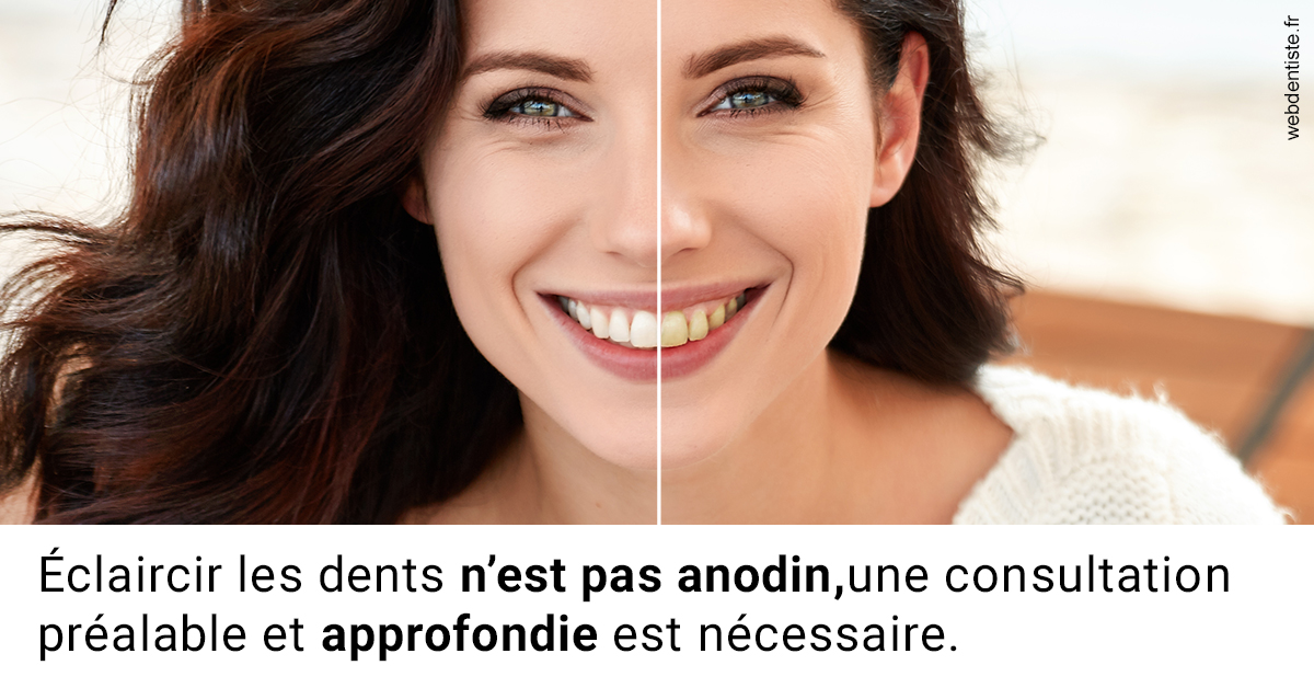 https://selarl-chirdentiste-drherve.chirurgiens-dentistes.fr/Le blanchiment 2