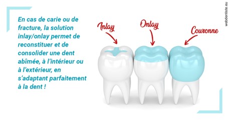 https://selarl-chirdentiste-drherve.chirurgiens-dentistes.fr/L'INLAY ou l'ONLAY