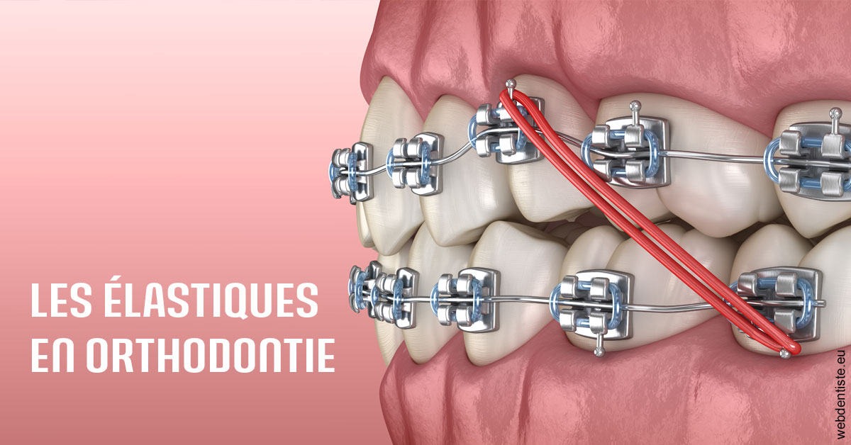 https://selarl-chirdentiste-drherve.chirurgiens-dentistes.fr/Elastiques orthodontie 2