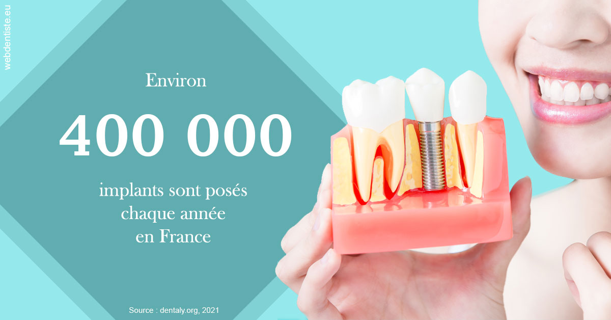 https://selarl-chirdentiste-drherve.chirurgiens-dentistes.fr/Pose d'implants en France 2
