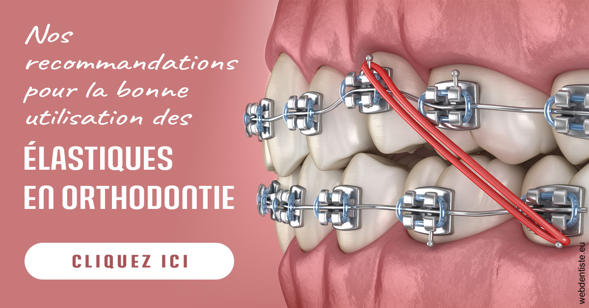https://selarl-chirdentiste-drherve.chirurgiens-dentistes.fr/Elastiques orthodontie 2